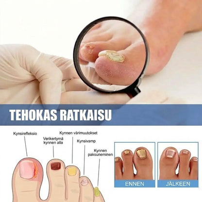 SilkEase™ Kynsisienen Hoitosarja & Laastarit