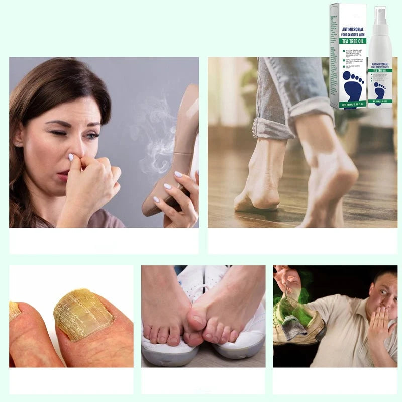 SilkEase™ Antibakteerinen Jalkasuihke (Hajunpoisto & Halkeilevat Kantapäät)