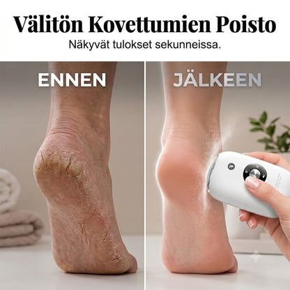 Pieni automaattinen jalkaraspi – Tehokas sähköinen kovettumien poistaja