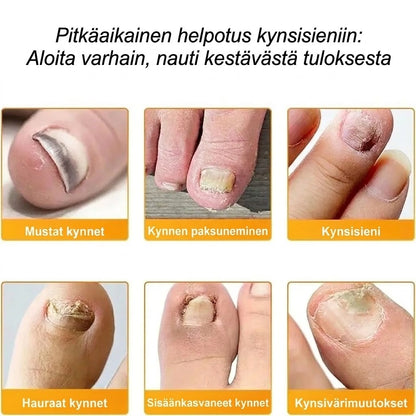 SilkEase™ Kynsisienen Hoitosarja & Laastarit